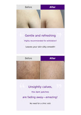 Before and after skin treatment results with a focus on calve dark patches fading away.