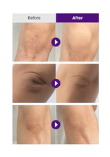 Before and after comparison of skin treatment on different body parts.