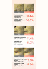 Before and after wrinkle improvement results with percentages shown on a light pink background.