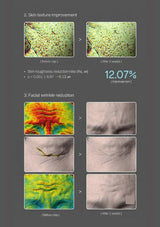 A dark gray infographic showing before-and-after results for skin texture and facial wrinkles. The layout includes text reading '2.