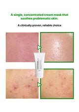 Cream mask for problematic skin with before and after effects on a white background