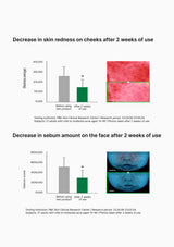 Chart and images showing decrease in skin redness and sebum amount on cheeks after 2 weeks of use.