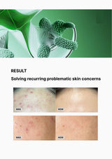 Before and after comparison of skin concerns with a green background and plant imagery.