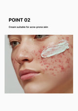 Cream applied to acne-prone skin with text indicating suitability for such skin types.