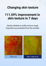 Advertisement showing before and after effects of skin texture improvement with text about improvement in 7 days.