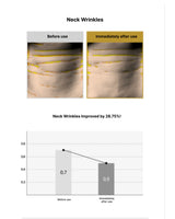 Before and after comparison of neck wrinkles with a graph showing improvement.