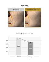 Before and after skin lifting treatment comparison with a graph showing improvement.