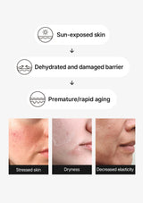 Diagram showing the effects of sun exposure on skin health with images of stressed, dry, and aged skin.