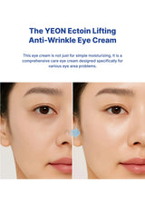 Advertisement for YEON Ectoin Lifting Anti-Wrinkle Eye Cream showing before and after effects on eye area.