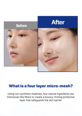 Before and after comparison of a person's face with text about a four-layer micro-mesh product.