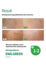 Before and after skin comparison with 'Was' and 'Now' labels, featuring EWG Green rating.