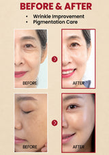 Before and after comparison of wrinkle improvement and pigmentation care on a beige background.