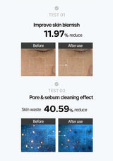 Before and after effect of skincare product on skin blemish and pores.