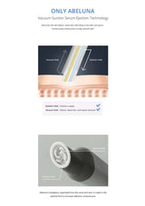Technical diagram of vacuum suction serum ejection technology with labeled parts and text.