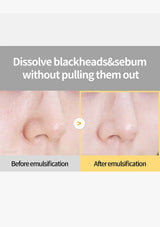 Before and after emulsification comparison of blackheads and sebum on skin.