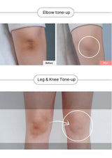 Before and after comparison of elbow and leg & knee tone-up treatments.