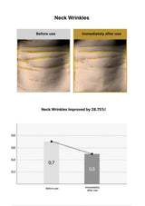 Before and after comparison of neck wrinkles with a graph showing improvement.