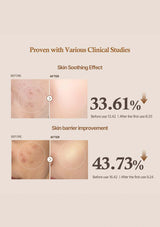 Before and after skin comparison with clinical study results on a beige background