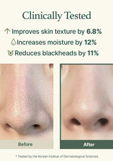 Before and after comparison of skin texture improvement with text indicating clinical testing results.