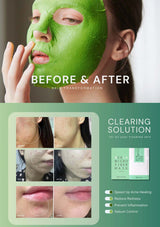 Before and after skin transformation with a green facial mask and product packaging.