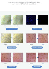 Before and after skin texture changes with text indicating KC Facial Health research center involvement.