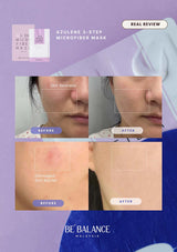 Advertisement for Azulene 3-step microfiber mask with before and after effects on skin.