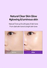 Before and after comparison of skin with natural clear skin glow on a purple background