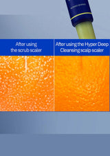 Comparison of scalp texture before and after using a scrub scaler and Hyper Deep Cleansing scalp scaler.