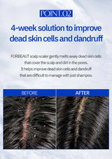 Advertisement for FORBEAUT scalp scaler with before and after images of scalp condition.