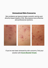 Advertisement for Axcene Booster Cream addressing unresolved skin concerns with images of skin with blemishes.