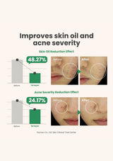 AXIS-Y Spot The Difference Blemish Treatment 15ml — clinical results; original brand product information