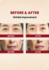 Before and after comparison of wrinkle improvement on a person's face.