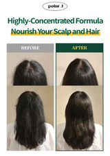 Before and after comparison of hair treatment showing improved scalp and hair health.