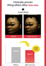 Before and after effects of a skincare product on a person's face, with text indicating clinically proven lifting effect.