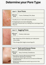 Chart detailing different types of pores with skin images and descriptions.