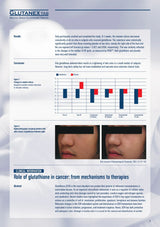 Medical document or report on Glutanex Tab with text and graphs.
