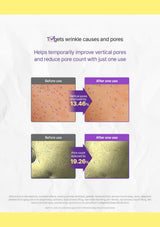 An informational marketing graphic for a skincare product. The graphic features a white background with a yellow top and bottom border.