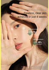 A close-up beauty ad showing a woman with hands framing her face, with text reading 'Flawless, clear skin achieved in just 4 weeks' and arrows noting decreased dark pigmentation and light pigmentation. The product itself is not visible, so this is not a Product/Packaging image.