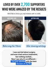 A promotional before-and-after graphic for a hair filling product. The top text reads 'LOVED BY OVER 2,700 SUPPORTERS WHO WERE AMAZED BY THE RESULTS.