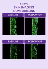 Two original baseline and follow-up skin imaging pairs, unretouched