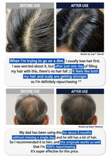 A collage of before-and-after hair growth results showing human scalp and hairline photos, with text reviews in English highlighting hair regrowth after use of an ampule product.