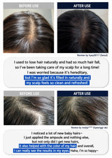 A before-and-after collage showing hair growth results on three different people. The top row shows close-up views of a scalp with thinning hair labeled 'BEFORE USE' and fuller, darker hair labeled 'AFTER USE'.
