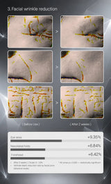 A promotional infographic showing before-and-after results for facial wrinkle reduction. The top section displays six close-up skin texture images arranged in a grid, with before-and-after comparisons.