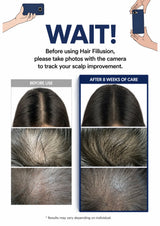 An informational comparison graphic for a hair filling product. It shows illustrated hands holding phones at the top, large text reading 'WAIT!', and before/after scalp photos under the heading 'Before using Hair Filling, please take photos with the camera to track your scalp improvement.
