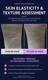 An informational graphic titled 'SKIN ELASTICITY & TEXTURE ASSESSMENT' with a dark navy background, before-and-after skin close-ups labeled 'BASELINE IMAGE' and 'FOLLOW-UP IMAGE,' and bullet points describing a human application test and measured results.