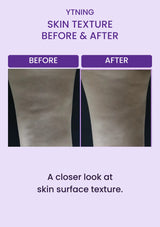 Original close-up skin-texture comparison photographs