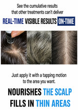 Promotional graphic for a scalp treatment, featuring three close-up photos of a scalp with hair thinning and text reading 'REAL-TIME VISIBLE RESULTS ON-TIME' and 'NOURISHES THE SCALP FILLS IN THIN AREAS'.