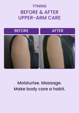 YTNING upper-arm before-and-after photographs, preserved without retouching