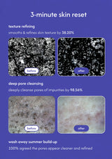 A promotional graphic for a '3-minute skin reset' showing before-and-after skin texture results on a purple background. The text lists three benefits: 'texture refining' with 38.