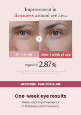 Medicube PDRN Pink Peptide Eye Cream — One-week eye results. Measured improvements in firmness and moisture.
